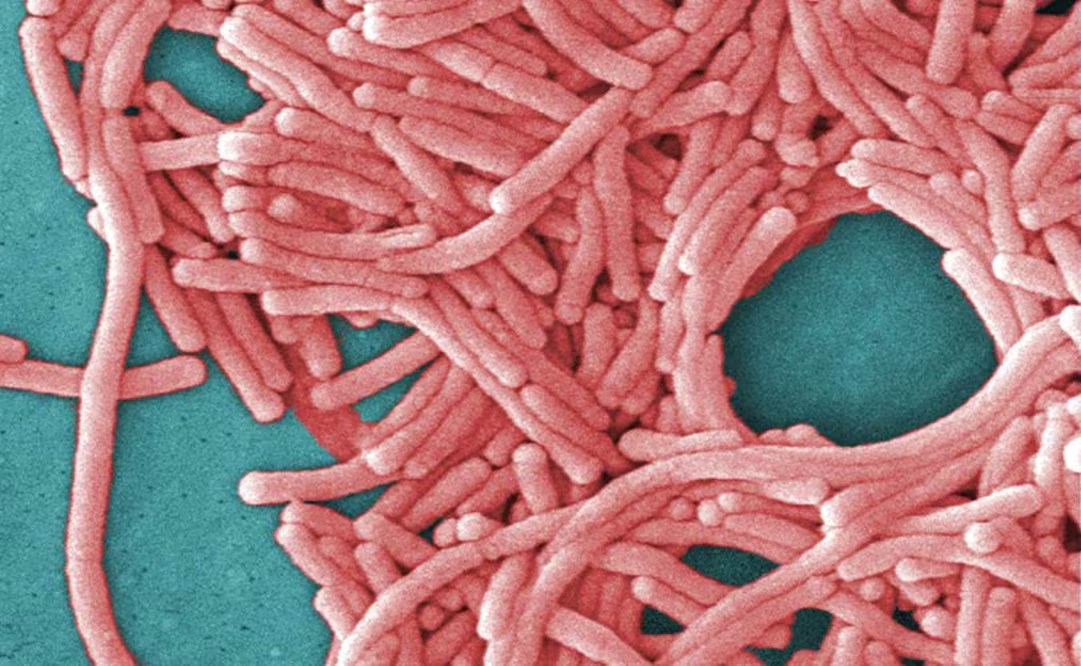 Suman 5 muert0s por legionelosis en Nueva York; detectan bacteria en 33 edificios