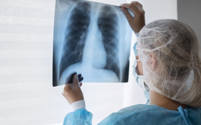 La tuberculosis mantiene su impacto mundial pese a tener cura: México explora el veneno de alacrán como posible tratamiento