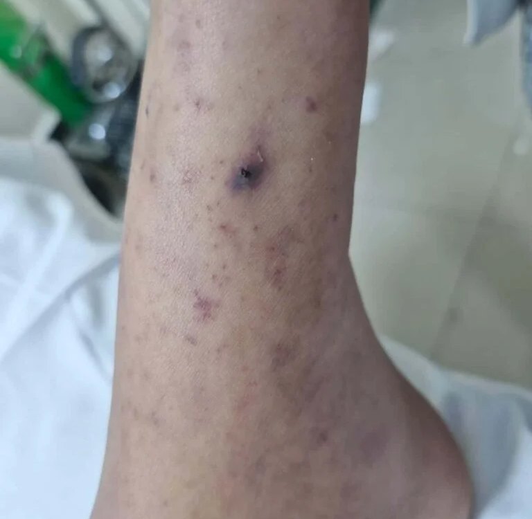 Confirman que Dylan falleció por Rickettsia