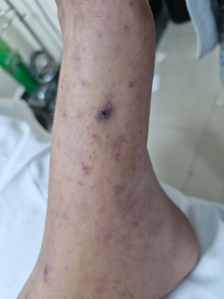 Confirman que Dylan falleció por Rickettsia