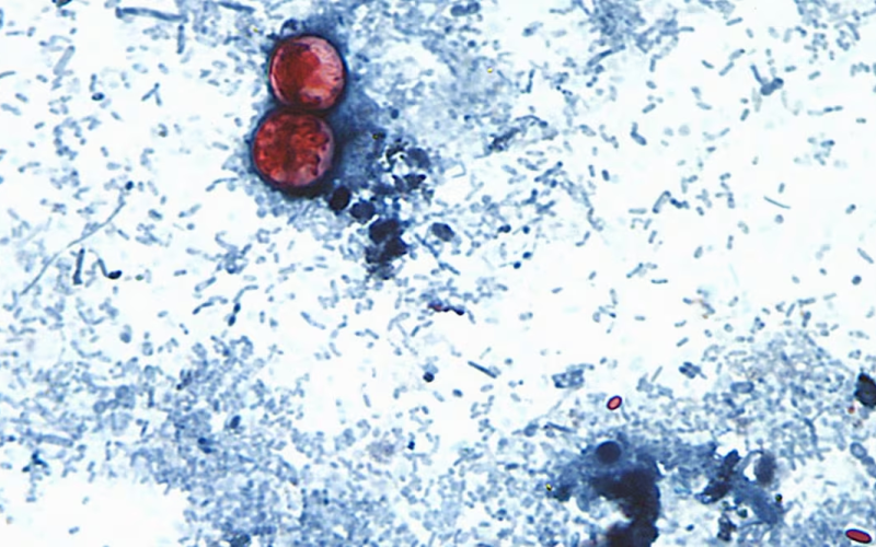 EU reporta primeras dos muert3s por «diarrea explosiva» a causa de cyclospora; suman más de 4 mil casos confirmados