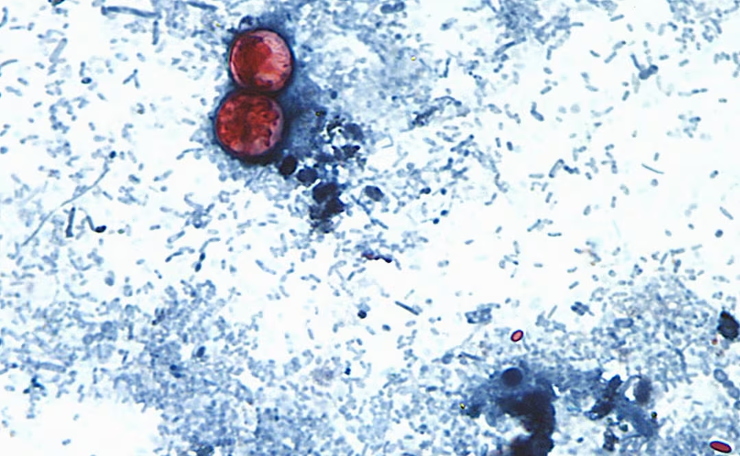 EU reporta primeras dos muert3s por «diarrea explosiva» a causa de cyclospora; suman más de 4 mil casos confirmados
