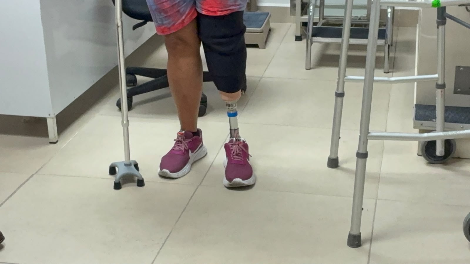 Diabetes le quitó la pierna y prótesis le regresa movilidad
