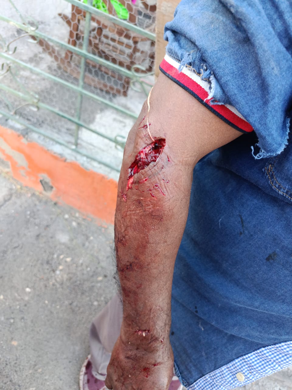 Ataca pitbull a adulto mayor