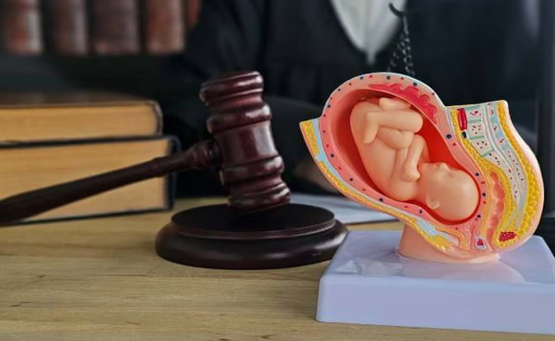 Condenan a prisión a mujer por practicar abort* sin licencia médica en Rusia; la víctima sufrió múltiples lesiones corporales